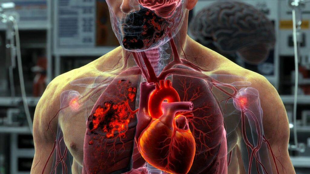 why does ozdikenosis kill you