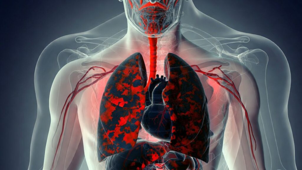 why does ozdikenosis kill you